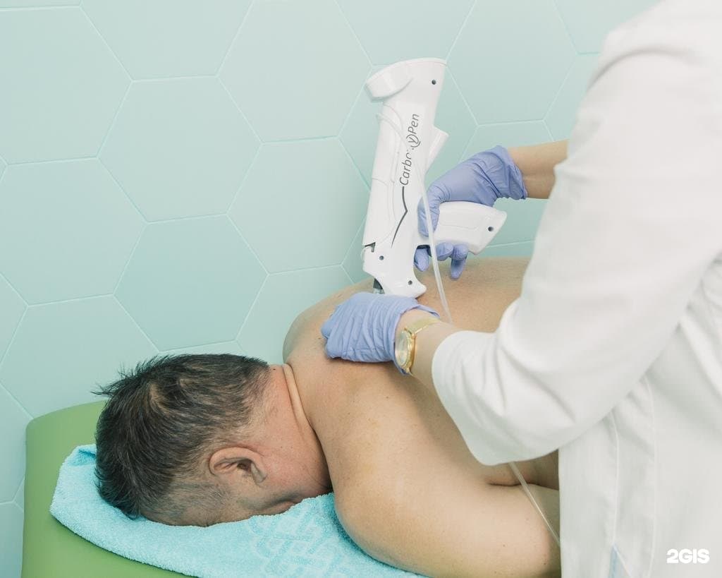 Карбокситерапия